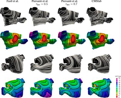 Rule-based definition of muscle bundles in patient-specific models of the left atrium